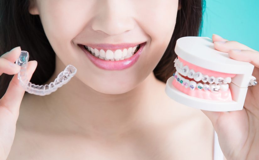 Straighter Teeth